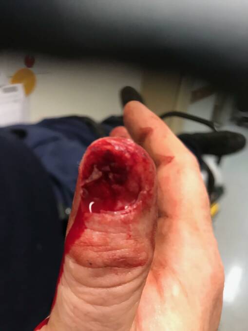 Police allege the male bit the police officer's finger while resisting arrest. Photo: NSW POLICE